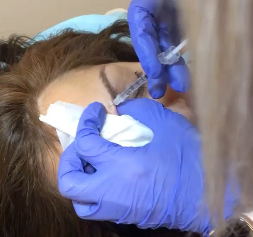 Botox
